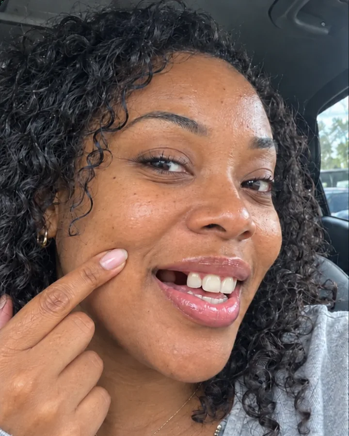 One side tooth missing