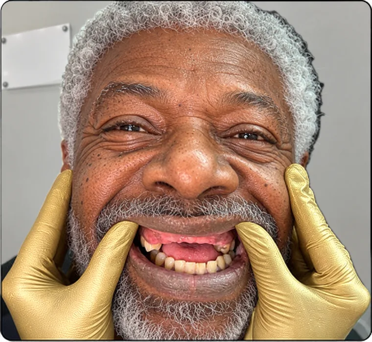 Faltan varios dientes superiores