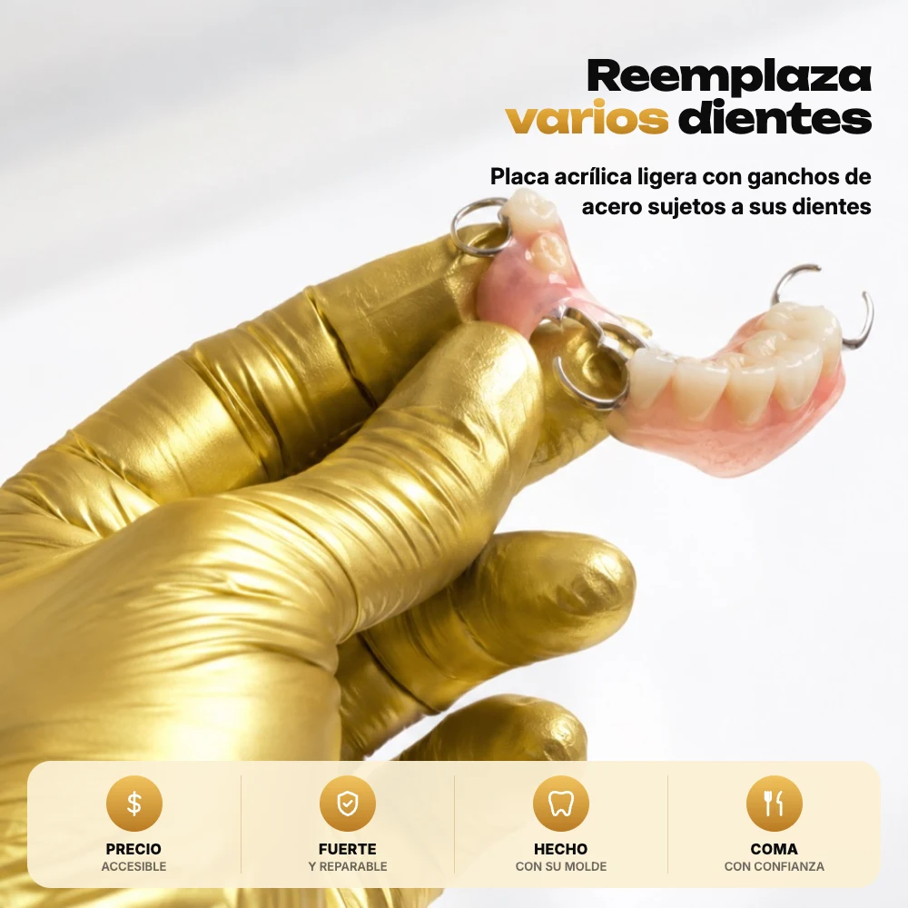 Dentadura parcial de acrílico con ganchos de acero reemplaza varios dientes