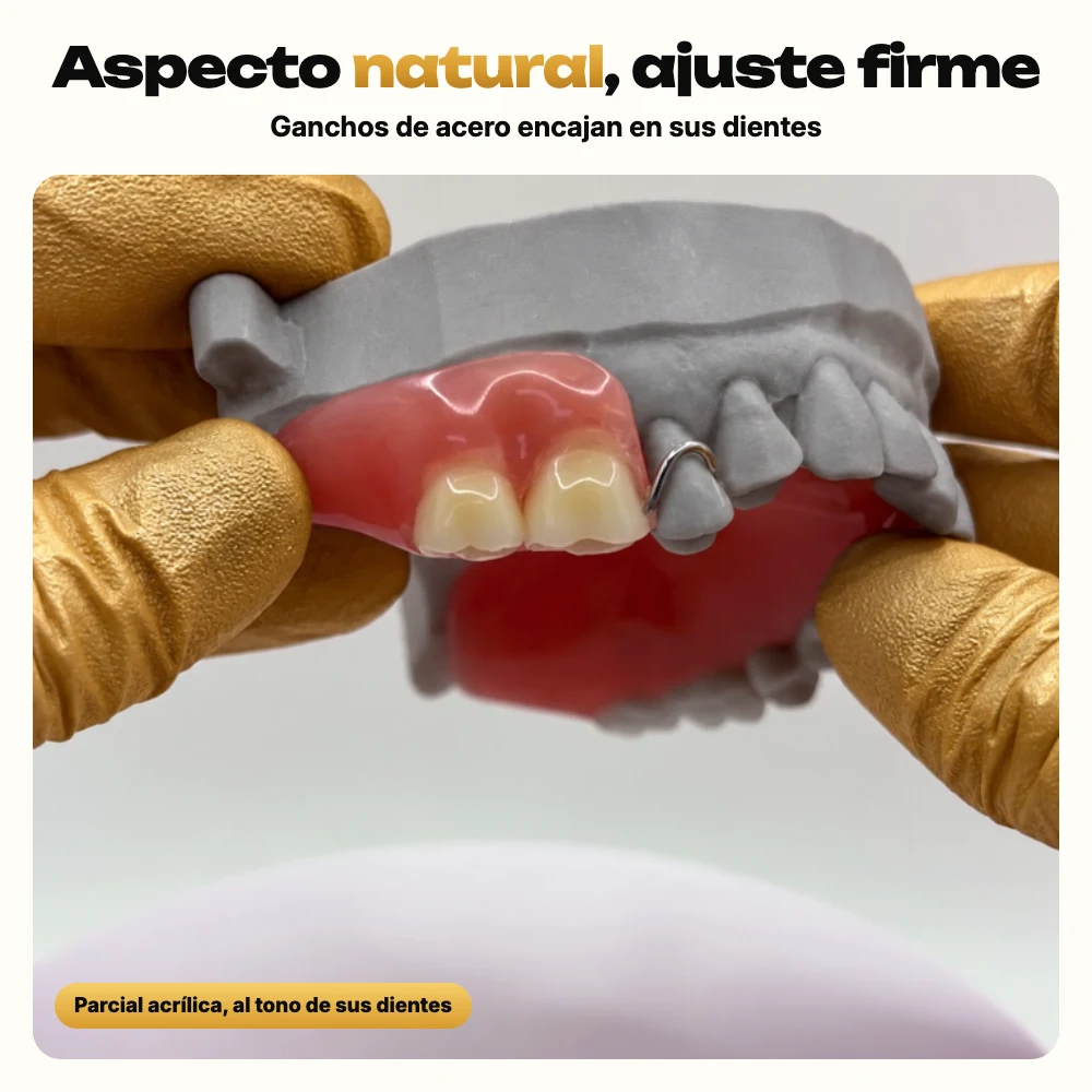 Dentadura parcial de acrílico con ganchos de acero en un modelo gris