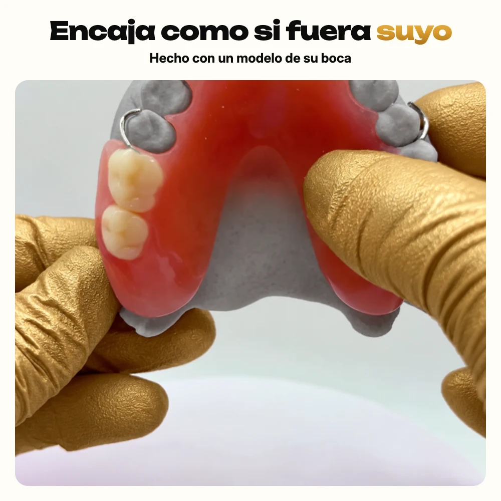 Dentadura parcial de acrílico en un modelo gris