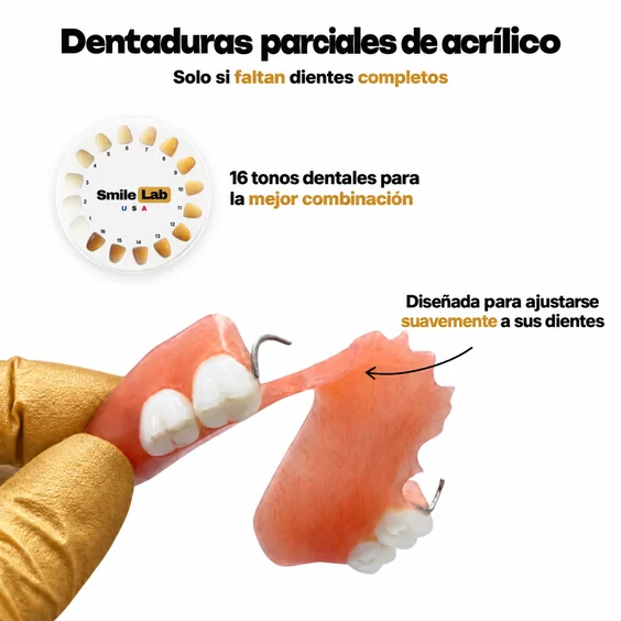Dentadura parcial de acrílico fabricada por Smile Lab USA