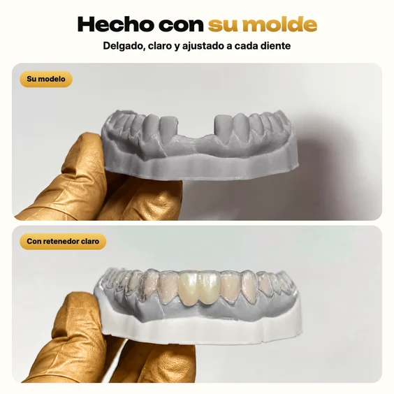 Retenedor transparente Essix hecho con su molde sobre un modelo gris