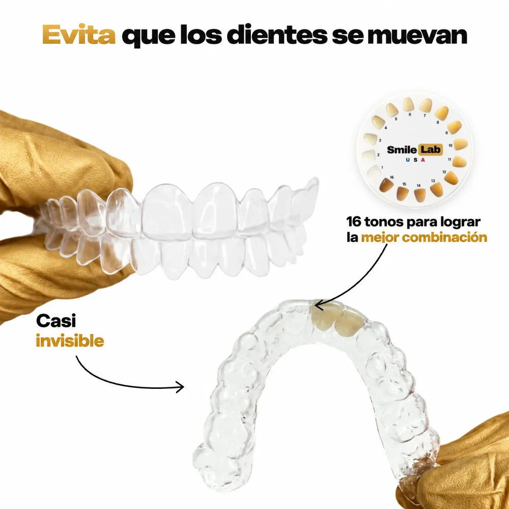 Beneficios del retenedor transparente: evita movimientos dentales no deseados y recaídas; fabricado sin BPA, ftalatos ni gluten