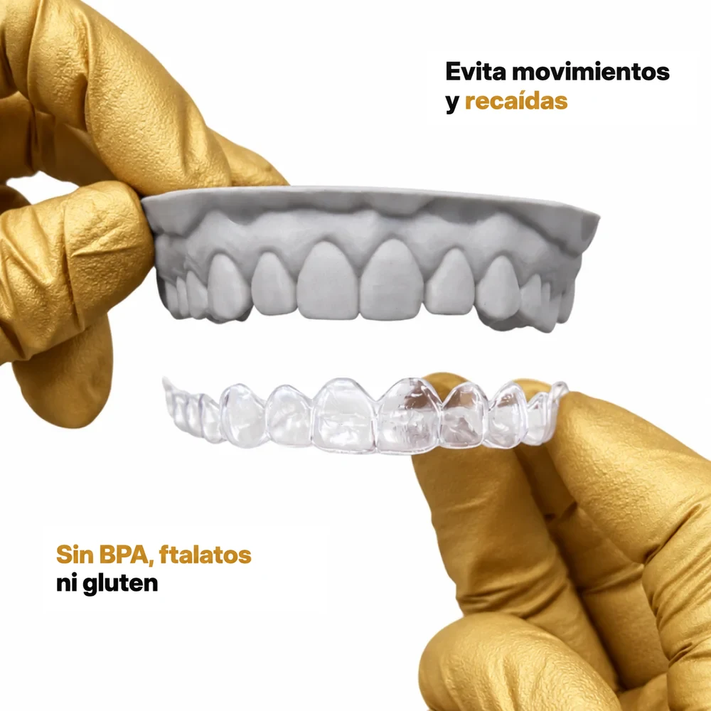 Retenedor transparente Essix sobre un modelo gris, sin BPA