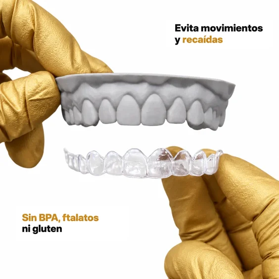 El retenedor transparente evita que los dientes se desplacen