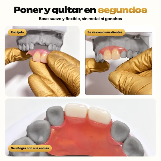 Dentadura parcial flexible colocada a presión sobre un modelo gris