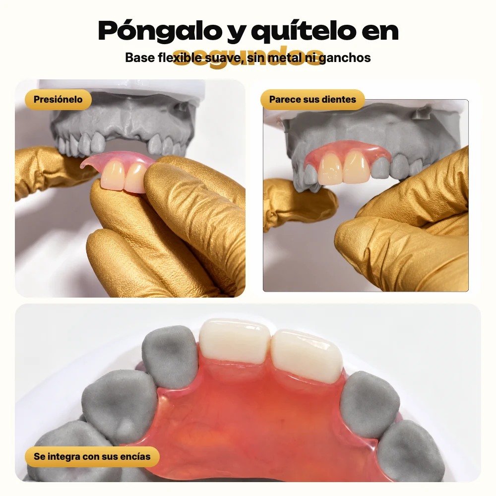 Flipper dental flexible ajustado sobre un modelo gris, sin metal
