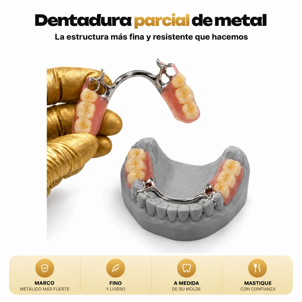 Dentadura parcial de metal colado con ganchos que se ajusta alrededor de los dientes naturales restantes