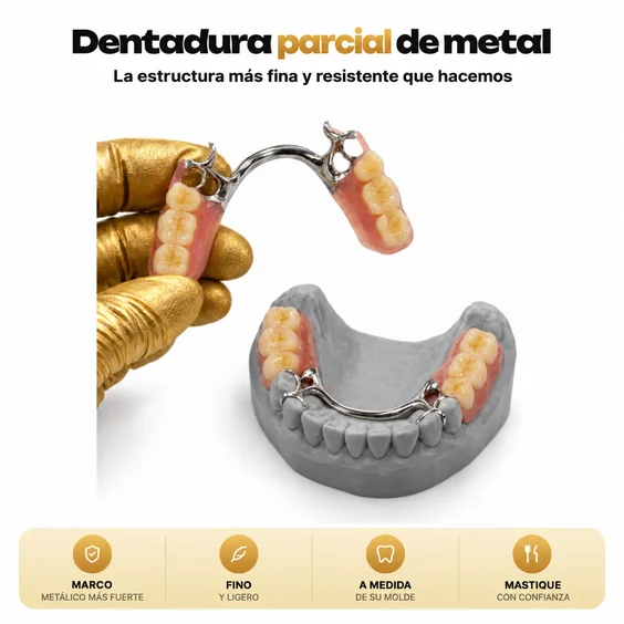Dentadura parcial de metal colado fabricada por Smile Lab USA