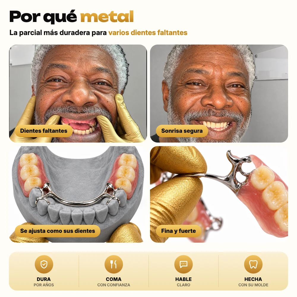 Por qué elegir una dentadura parcial de metal: antes y después, queda como sus propios dientes