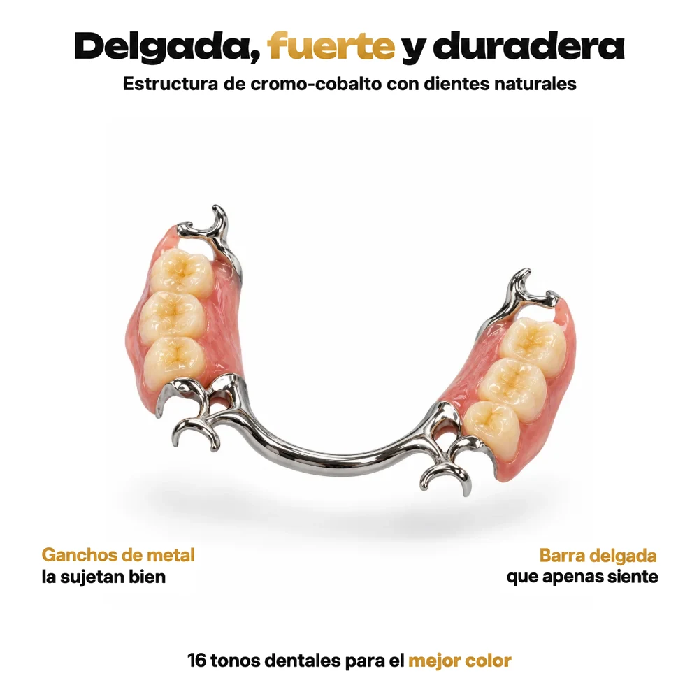 Dentadura parcial de metal con estructura delgada de cromo-cobalto