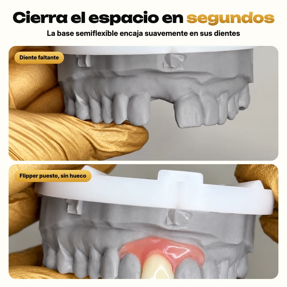 Diente postizo removible semiflexible que cubre el espacio en un modelo gris