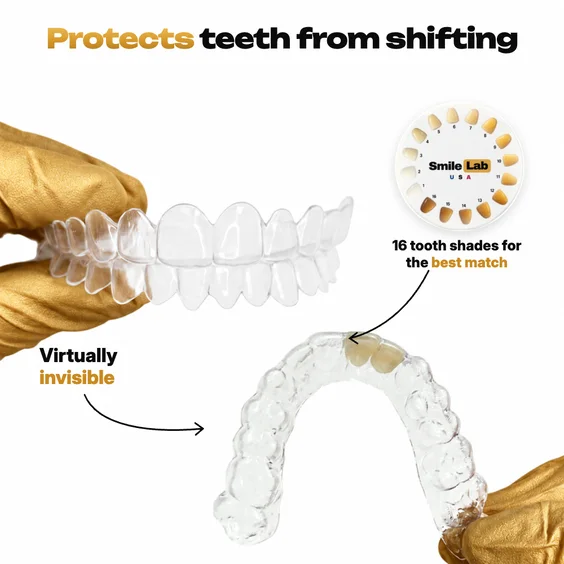 Essix retainer