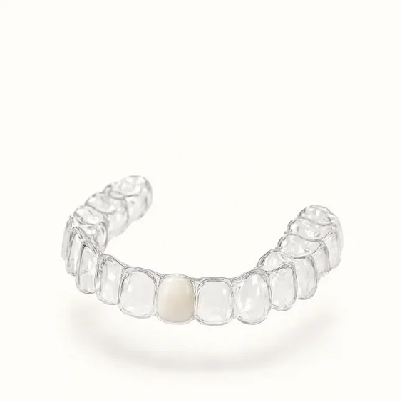 prevent teeth from shifting