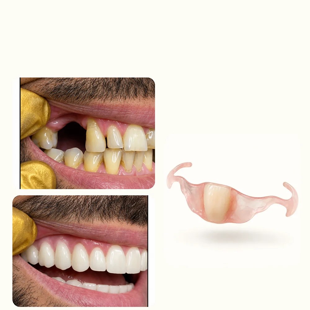 flexi-flipper-ba