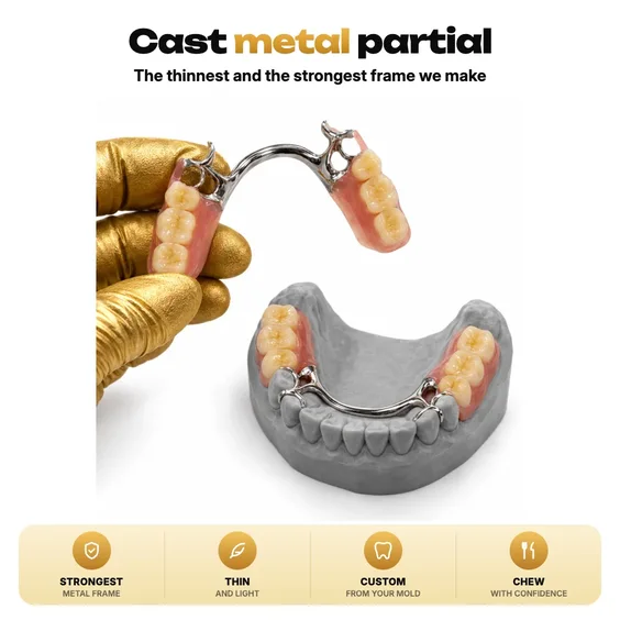 Parcial de metal