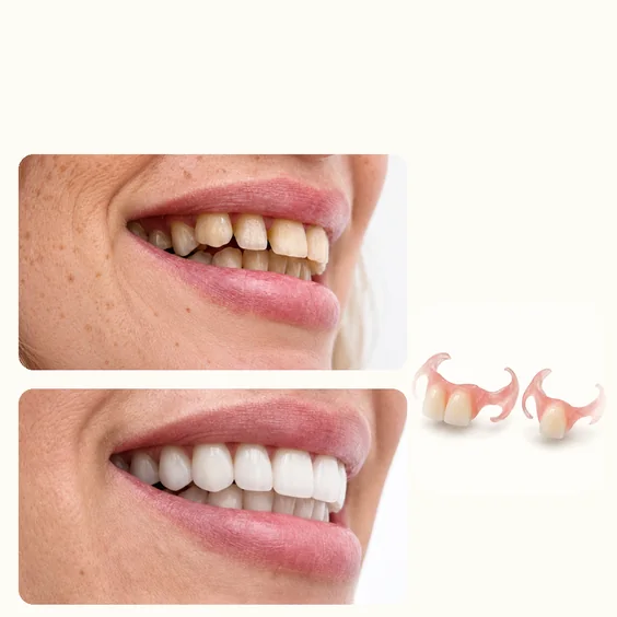 Semi flex flipper blends with your gums and matches your teeth color