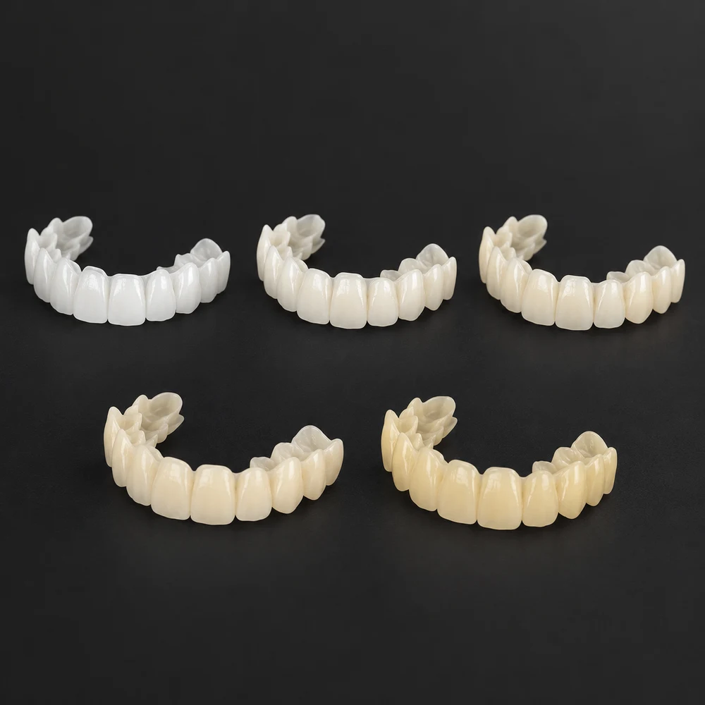 5 snap-on veneer shades side by side