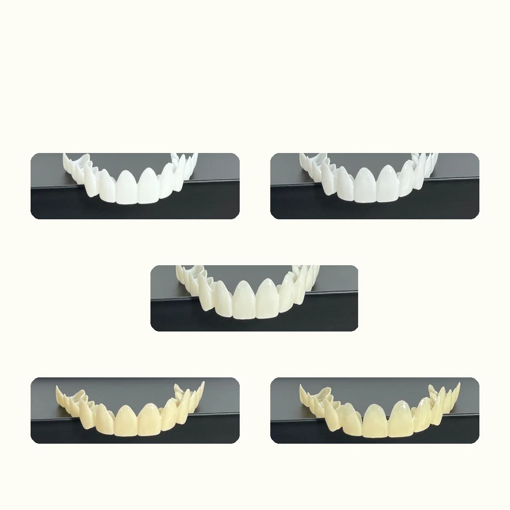 Snap-on veneers in five shades: Snow White, Pearl, Vanilla, Chardonnay and Caramel