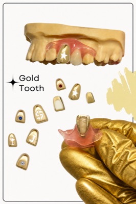 Gold tooth