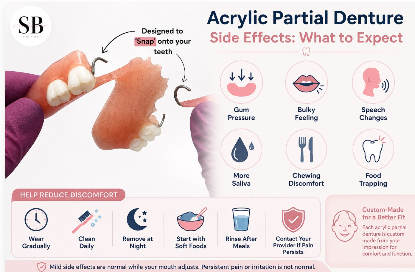 Acrylic partial denture side effects infographic showing a custom removable acrylic partial denture, common adjustment concerns, and how the appliance snaps securely onto natural teeth.
