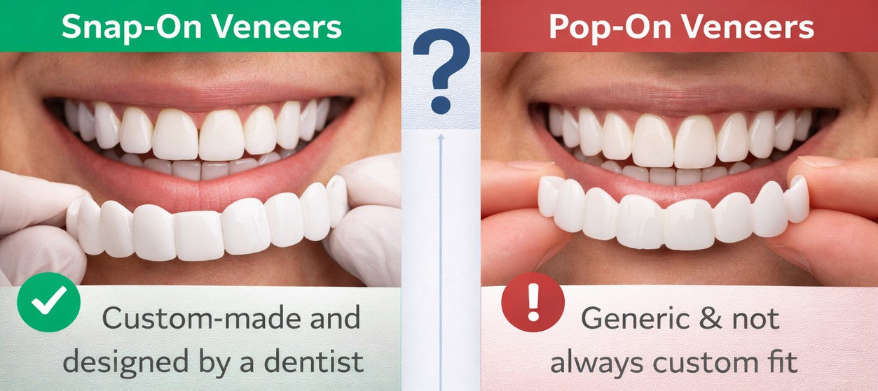 Are_Snap-On_Veneers_and_Pop-On_Veneers_Ever_the_Same