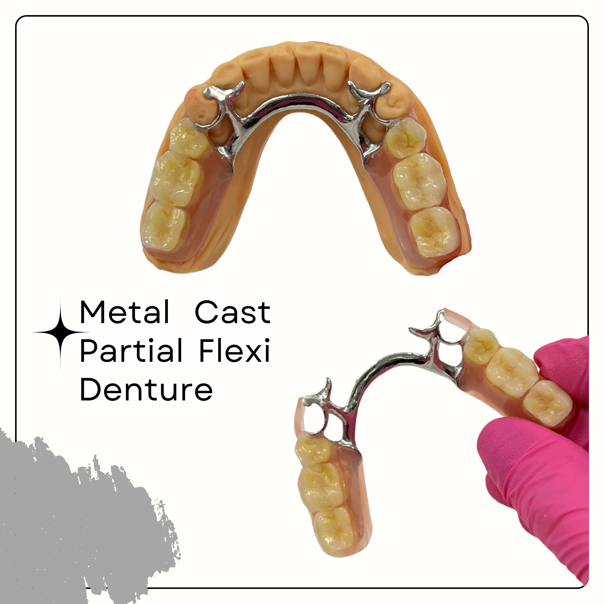 Denture_Flexi_Metal