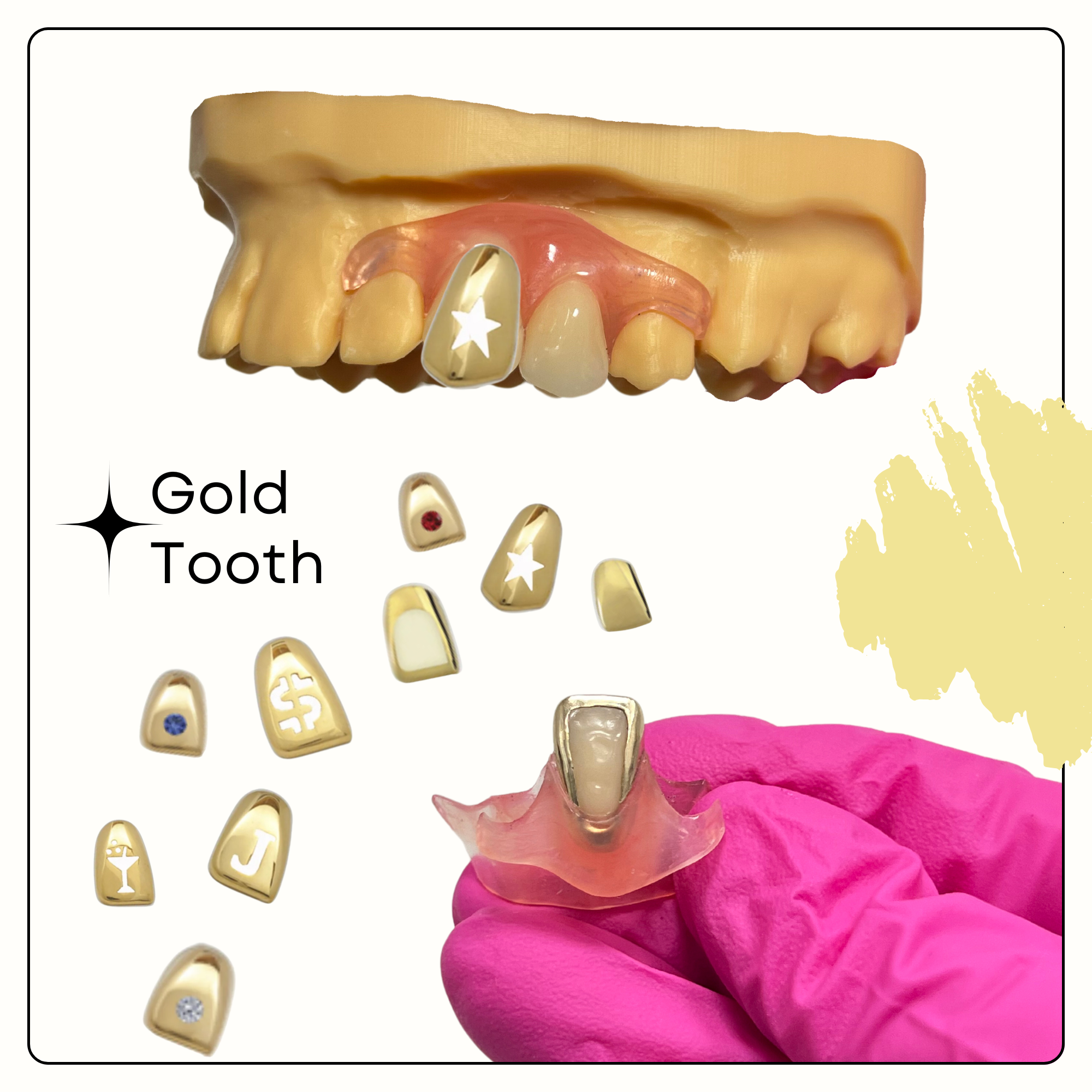 Gold_Tooth