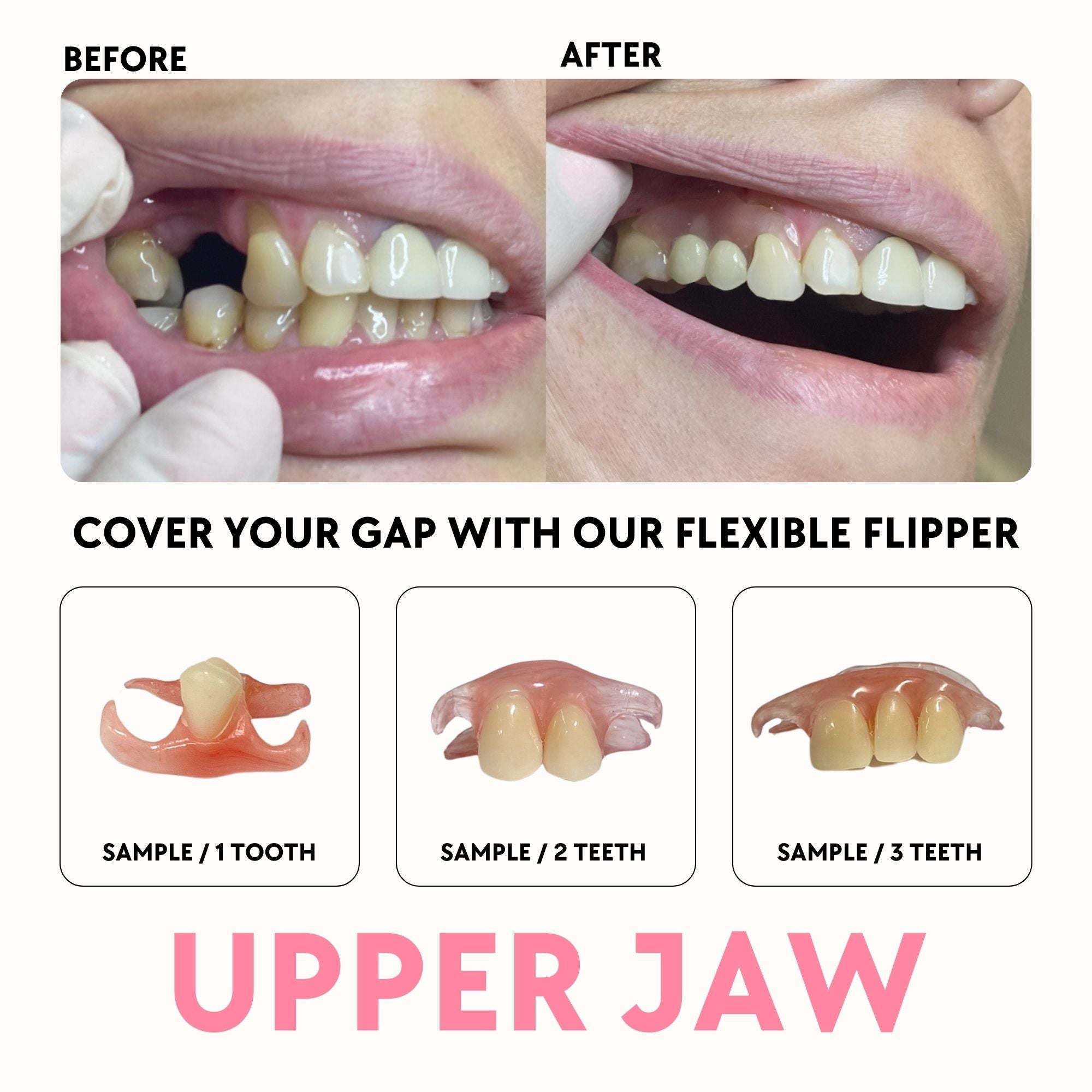 Flexi - Smile Lab USA
