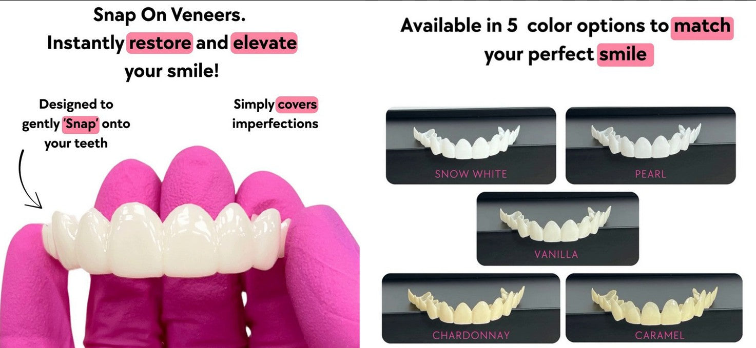 Pricing and Shade Options - Top-Rated Span-on Veneers