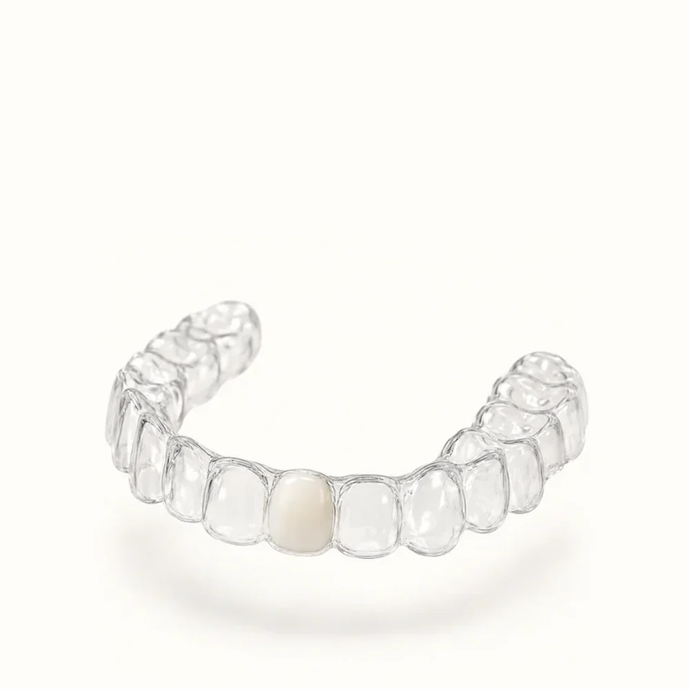 Essix retainer covers the gap and keeps teeth from shifting while you wait