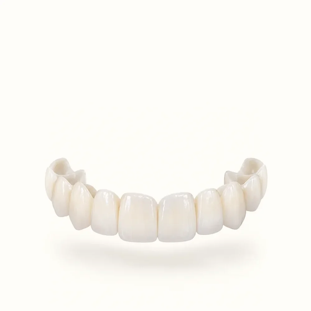 Snap-on veneers instantly restore and elevate your smile - snaps onto teeth, simply covers imperfections