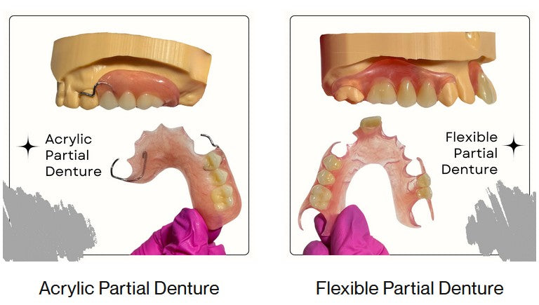 partial_dentures